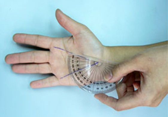 Góc ATD được xác định bởi 3 giao điểm trên lòng bàn tay